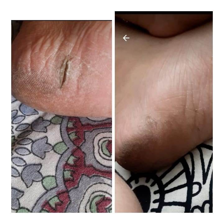 Skin allergy treatment with Dr poonam homeopathy homeopathic clinic In Balewadi Baner