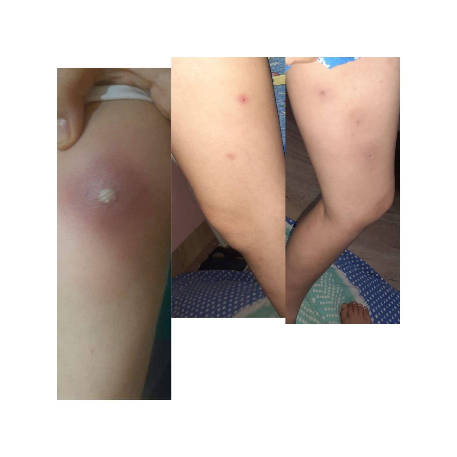 skin allegy treatment with Dr poonam homeopathy homeopathic clinic In Balewadi Baner